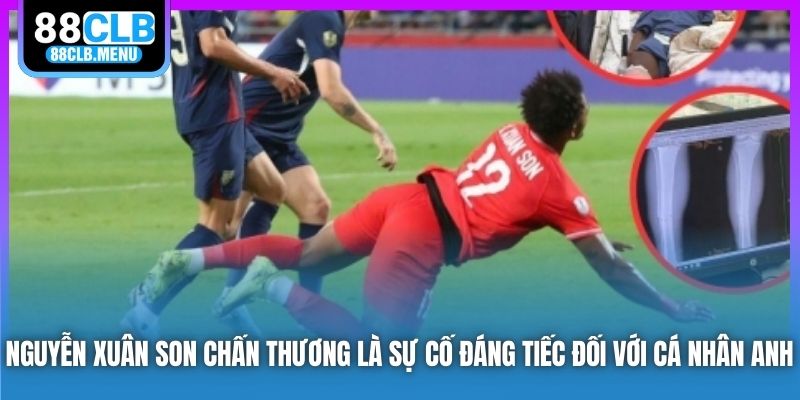 Nguyễn Xuân Son chấn thương là sự cố đáng tiếc đối với cá nhân anh